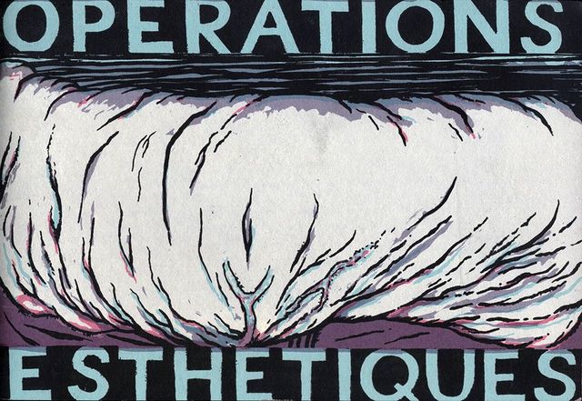Opérations esthétiques