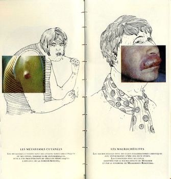Double page extraite de Sublime maladie, Céline Guichard, éd. Strane Dizioni - 2012